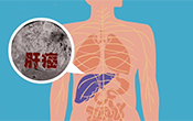 我國科學家牽頭 肝癌免疫聯合治療研究成果在國際醫學期刊發表